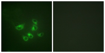 TPH1 rabbit pAb Antibody