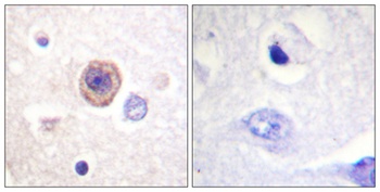 TPH1 rabbit pAb Antibody