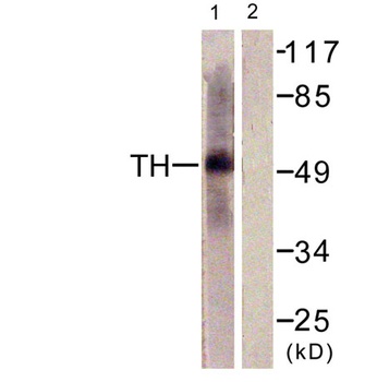 TPH1 rabbit pAb Antibody
