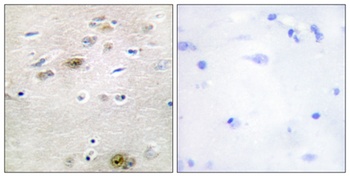 Tra-2α rabbit pAb Antibody