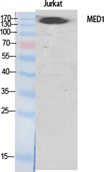 TRAP220 rabbit pAb Antibody