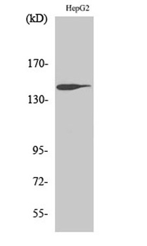 Trk B rabbit pAb Antibody
