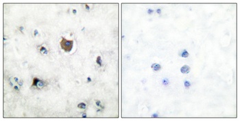 Trk B rabbit pAb Antibody