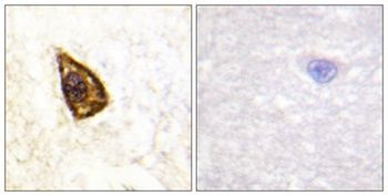 Trk B rabbit pAb Antibody