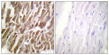 Troponin I-C rabbit pAb Antibody