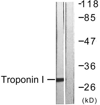 Troponin I-C rabbit pAb Antibody