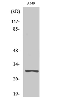 Trypsin-3 rabbit pAb Antibody