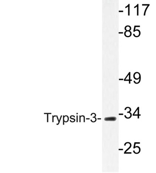 Trypsin-3 rabbit pAb Antibody