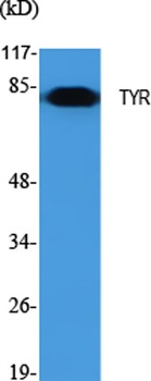 TYR rabbit pAb Antibody