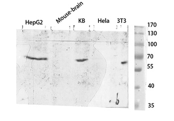 TYR rabbit pAb Antibody