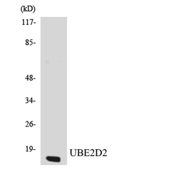 UBE2D2 rabbit pAb Antibody