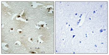 UTP14A rabbit pAb Antibody