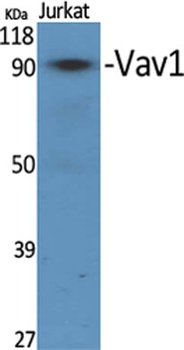 Vav1 rabbit pAb Antibody