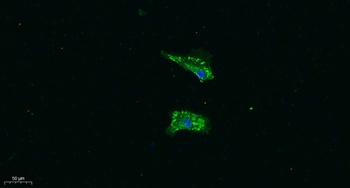VEGF-B rabbit pAb Antibody