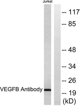 VEGF-B rabbit pAb Antibody