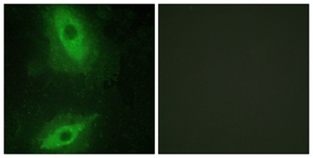 VEGI rabbit pAb Antibody