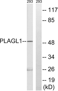 ZAC1 rabbit pAb Antibody