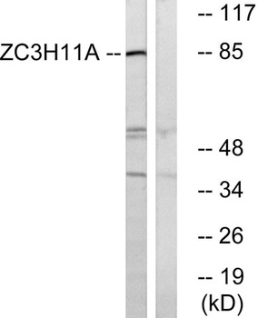 ZC3H11A rabbit pAb Antibody