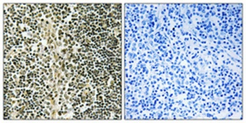 ZNF225 rabbit pAb Antibody