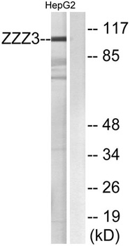 ZZZ3 rabbit pAb Antibody