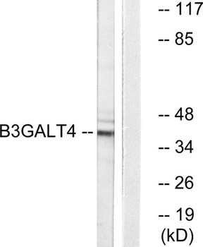 β-1,3-Gal-T4 rabbit pAb Antibody