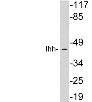 Ihh rabbit pAb Antibody