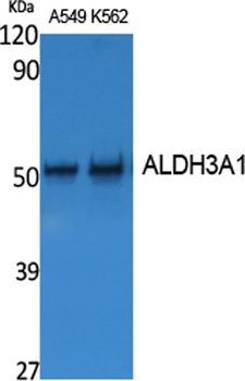 ALDH3A1 rabbit pAb Antibody