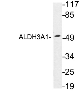 ALDH3A1 rabbit pAb Antibody