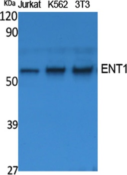 ENT1 rabbit pAb Antibody