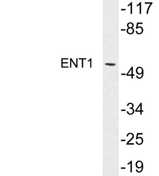 ENT1 rabbit pAb Antibody