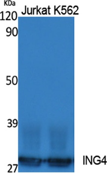 ING4 rabbit pAb Antibody