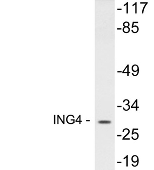 ING4 rabbit pAb Antibody