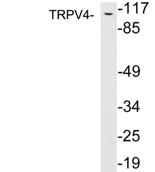 TRPV4 rabbit pAb Antibody