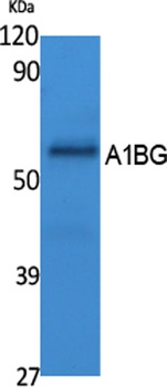 A1BG rabbit pAb Antibody