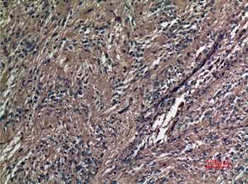 A1BG rabbit pAb Antibody