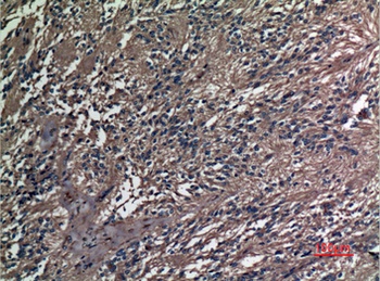 A1BG rabbit pAb Antibody