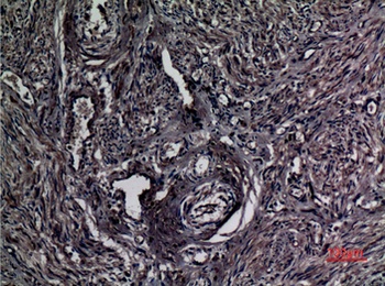 A1BG rabbit pAb Antibody