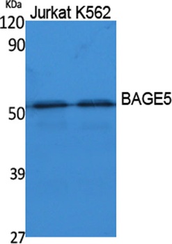 BAGE5 rabbit pAb Antibody