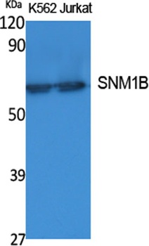 SNM1B rabbit pAb Antibody