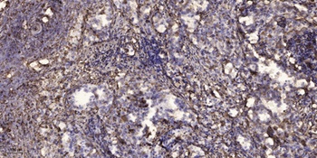SNM1B rabbit pAb Antibody