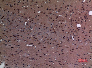 Stathmin-2 rabbit pAb