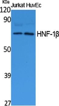 HNF-1β rabbit pAb Antibody