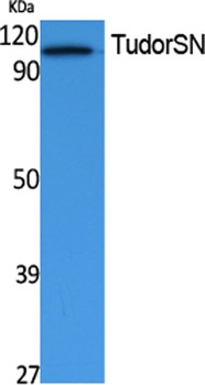 TudorSN rabbit pAb Antibody
