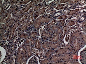 ZNF227 rabbit pAb Antibody
