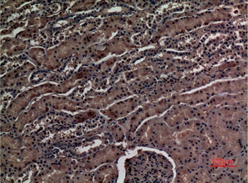 ZNF227 rabbit pAb Antibody