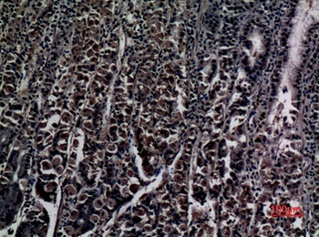 ZNF227 rabbit pAb Antibody