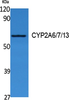 CYP2A6/7/13 rabbit pAb Antibody