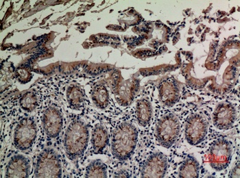 TRPV3 rabbit pAb Antibody