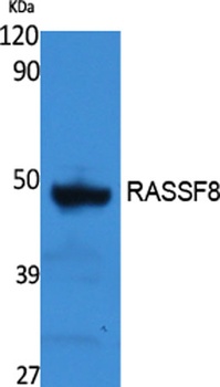 RASSF8 rabbit pAb Antibody
