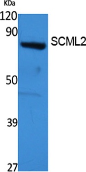 SCML2 rabbit pAb Antibody